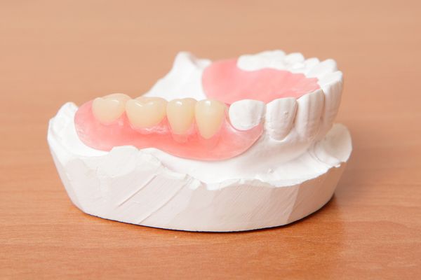 A partial denture replaces missing teeth.