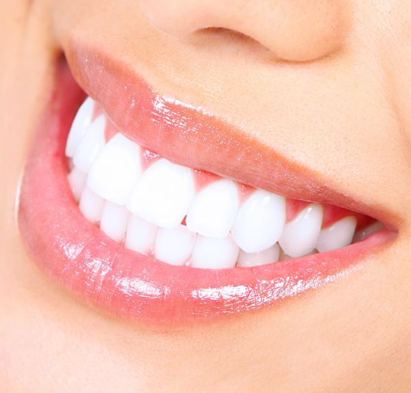 Teeth whitening at Hassid Dental.