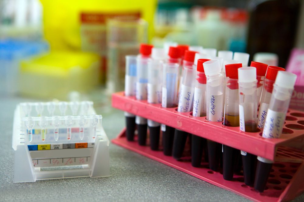 Image of lab test Acts Pharmacy and Healthcare Services