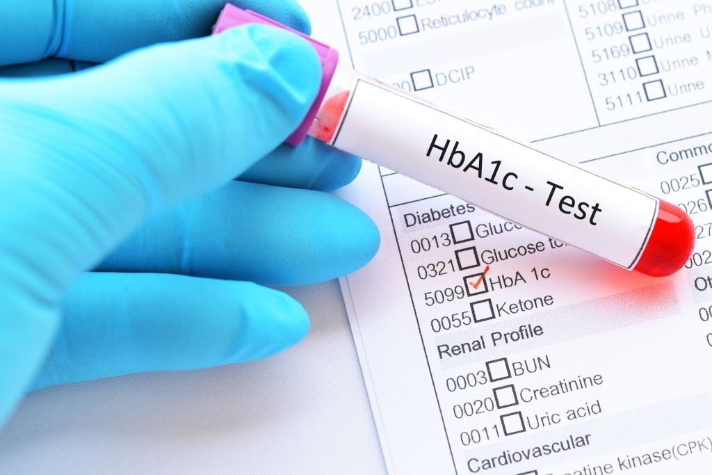 HbA1c Photo.jpg