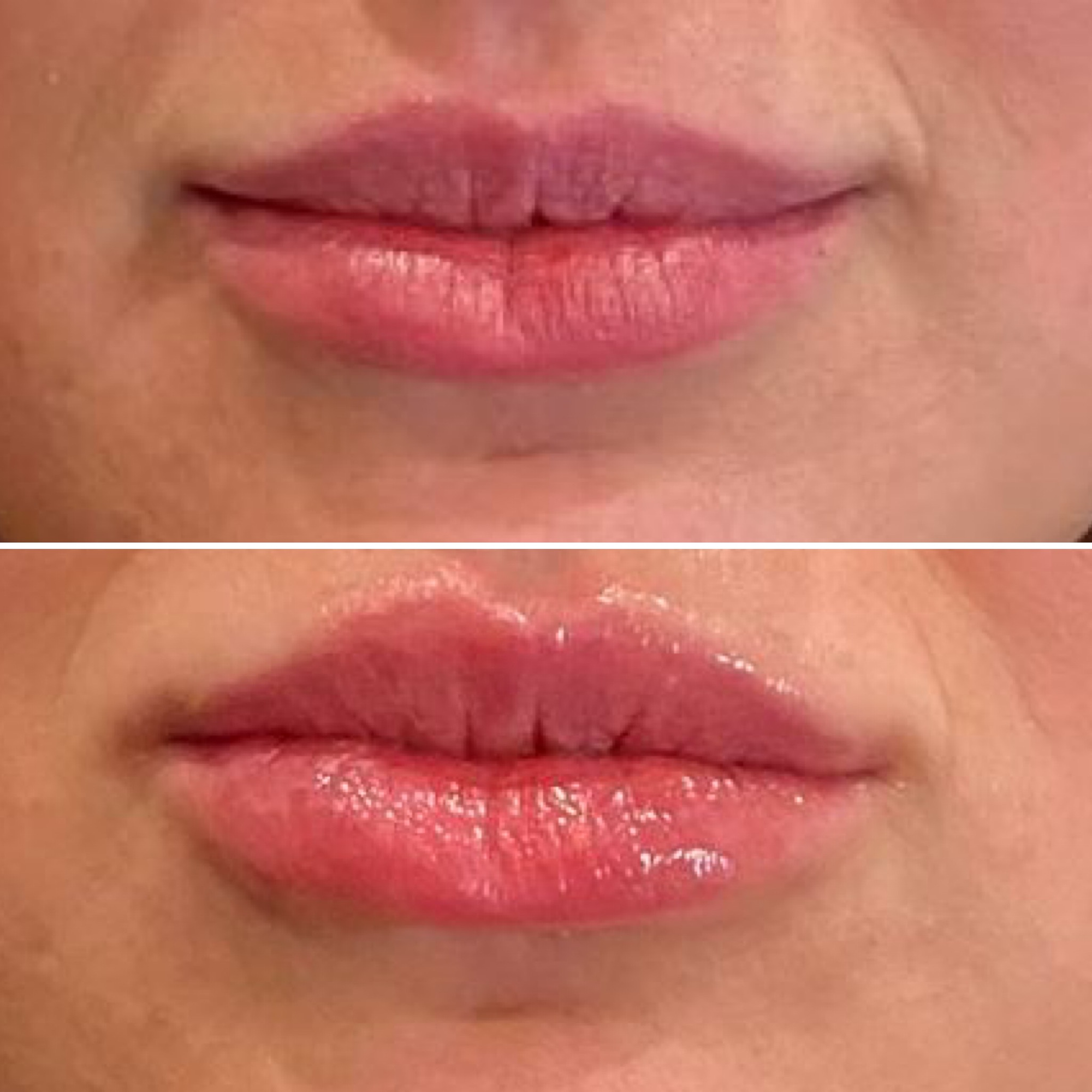 Before and after. Photo cred_ @hobbssalonmedspa.png