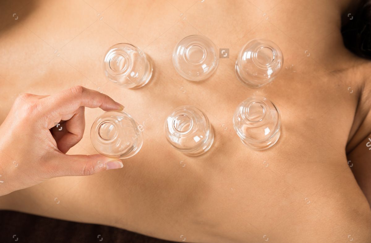 stock-photo-close-up-of-therapist-s-hand-placing-cups-on-woman-s-back-276629465.jpg