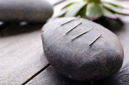 stock-photo-needle-for-acupuncture-on-spa-stones-on-table-close-up-284445482.jpg