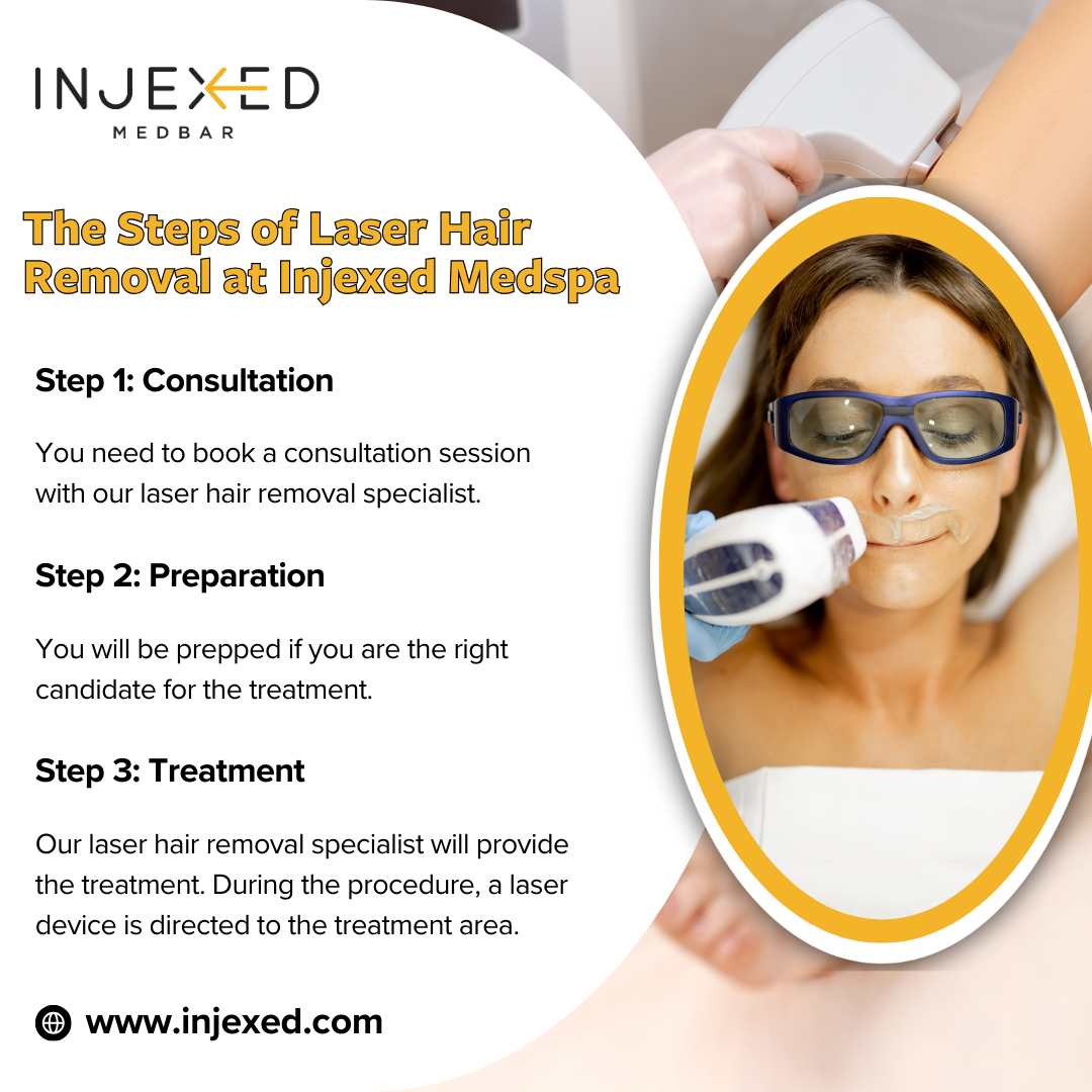 The Steps of Laser Hair Removal at Injexed Medspa.png