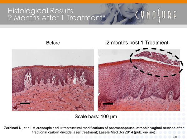 Vaginal tissue changes