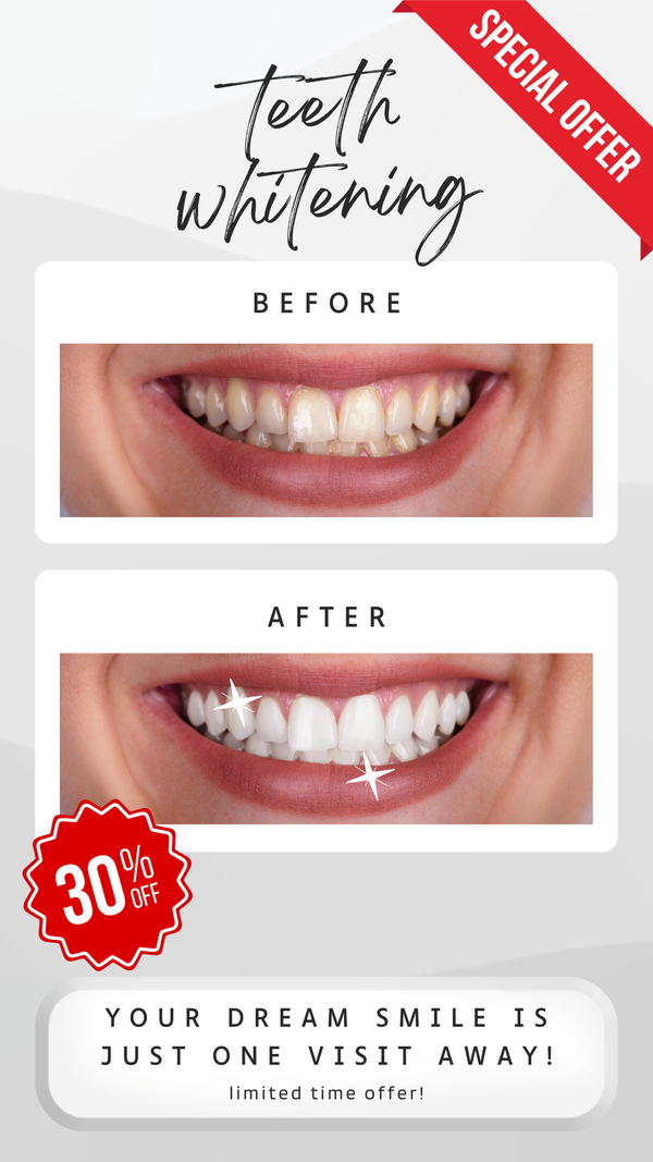 Grey White Modern Teeth Whitening Before After Photo Instagram Story .png
