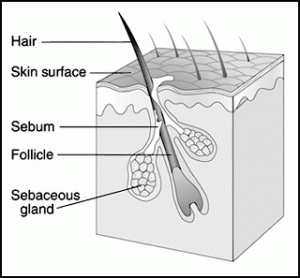 sebaceous-glands-and-acne_3_2515-300x278.gif
