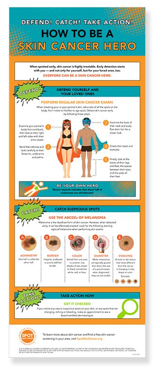 be-a-skin-cancer-hero-infographic-thumbnail.jpg