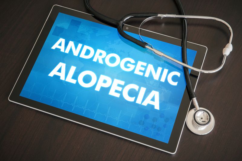 Androgenic Alopecia.jpg