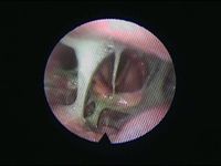 endoscope insetion.jpg