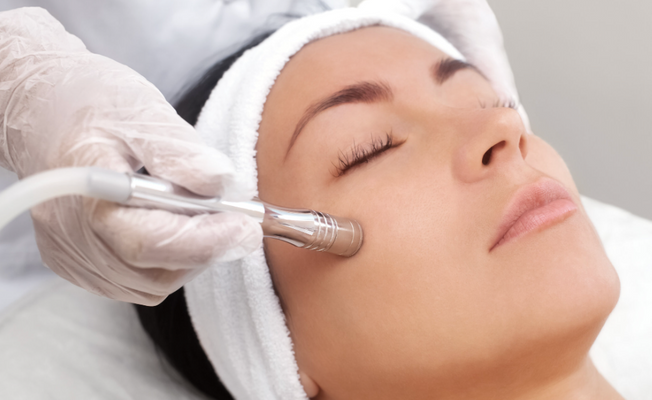 $25 | Microdermabrasion