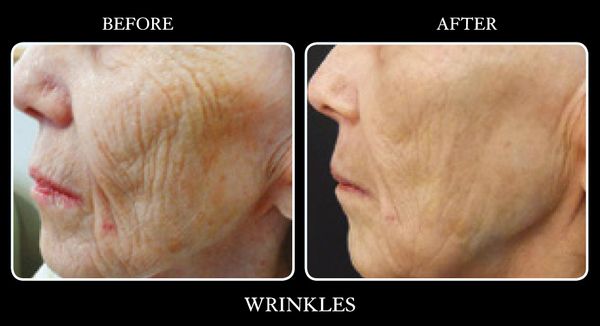 wrinkles02.jpg