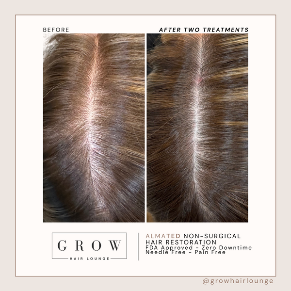 Copy of AlmaTED B&A Template (500 x 500 px) (2000 x 2000 px).png