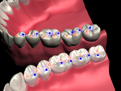 Tooth Equilibration.jpg