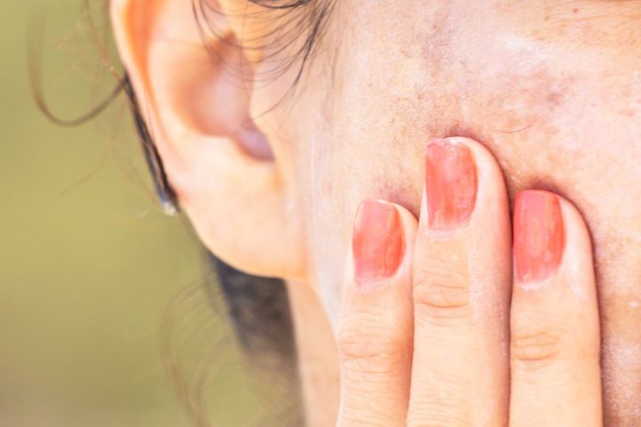 The Ultimate Guide to Fighting Pigmentation & Uneven Skin Tone After 40.jpg