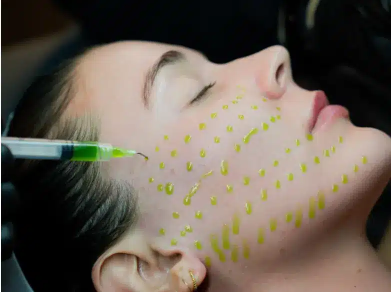 Introducing BioRePeel: The Ultimate Solution for Radiant Skin ...