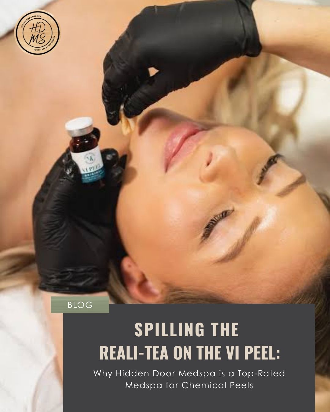 Spilling the Reali-TEA on the VI Peel (1).jpg