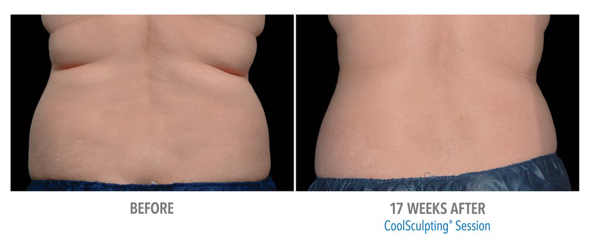 Female Flanks, Back View, Training Center East_Large2.jpg