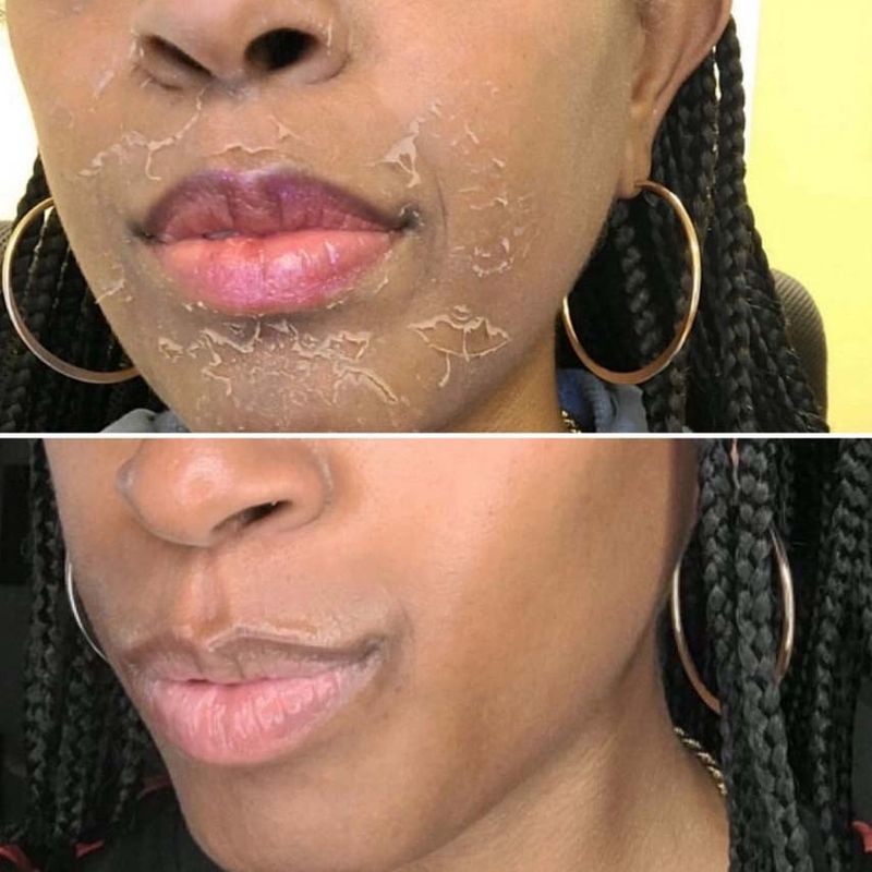 glutathione iv los angeles IV Therapy Los Angeles | IV Drips in LA - Kalologie