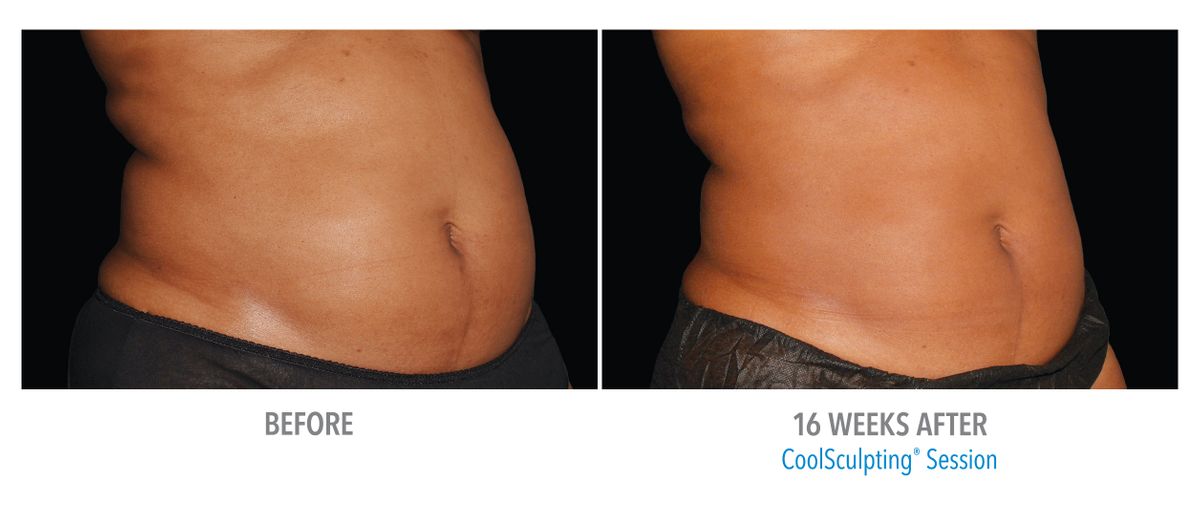 Female Flanks, Front Left View, Training Center East_large.jpg