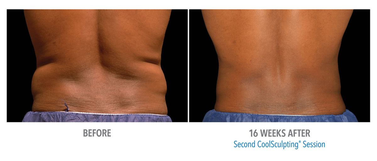 Male Flanks, Back View, Bodify and Steven Sorr.jpg