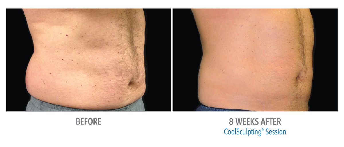 Male Abdomen, Photo Courtesy of Dr. Haynes_Medium.jpg