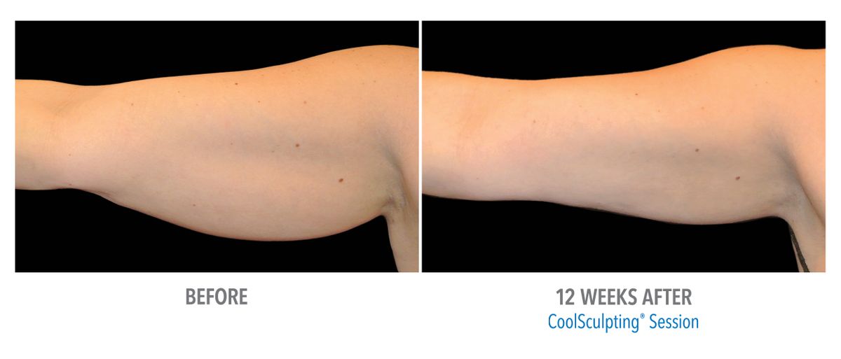 Female Arms, Photo Courtesy of Amy Brenner, MD.jpg