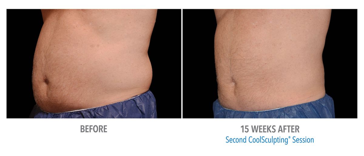 Male Abdomen, Photo Courtesy of Bodify and Steven Sorr2.jpg