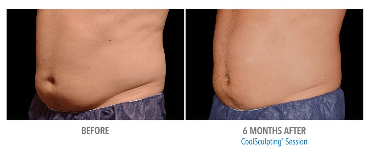 Male Abdomen, Photo Courtesy of Bodify and Steven Sorr.jpg