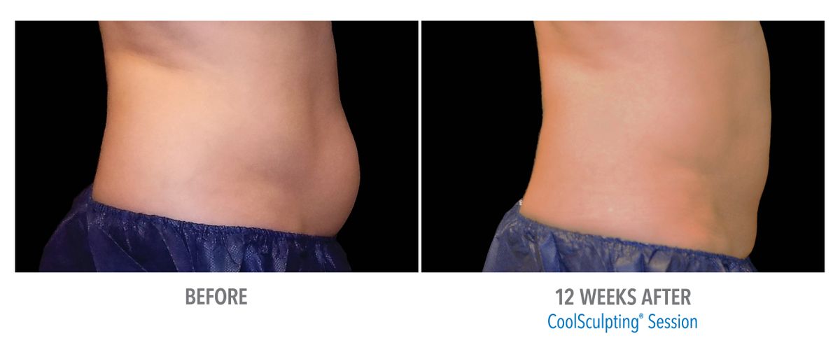 Female Abdomen, Photo Courtesy of Bodify and Steven Sorr4.jpg