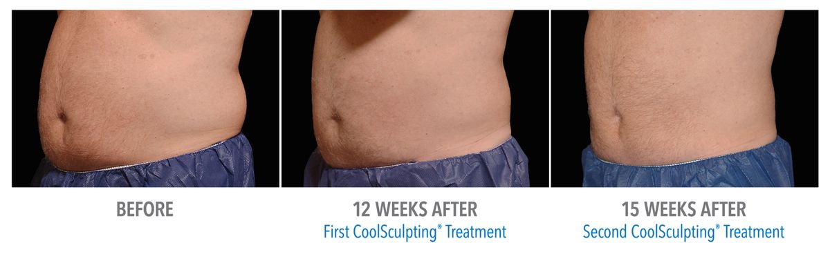 Male Abdomen, Photo Courtesy of Bodify and Steven Sorr3.jpg