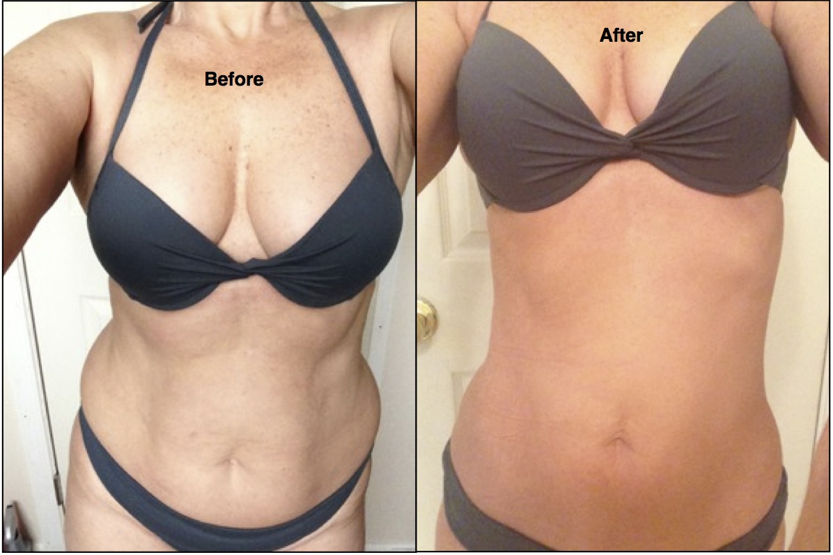 24.5 total inches lost! 54 yr. old female
