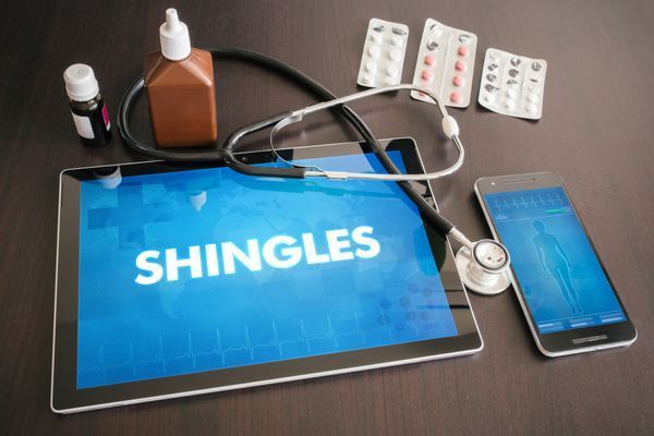 shingles
