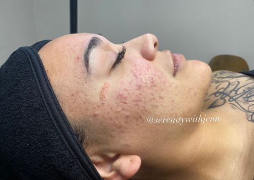 Face Reality Before — Pensacola