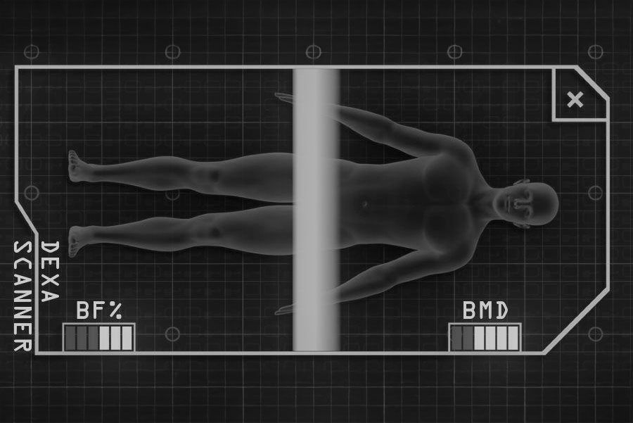 dexa.jpg