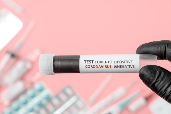 COVID-19 Rapid Testing Negative