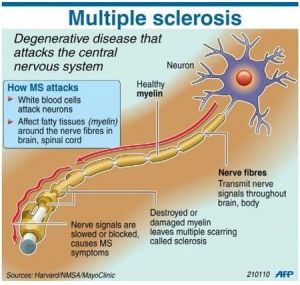 Multiple-Sclerosis-pill1-300x285.jpg