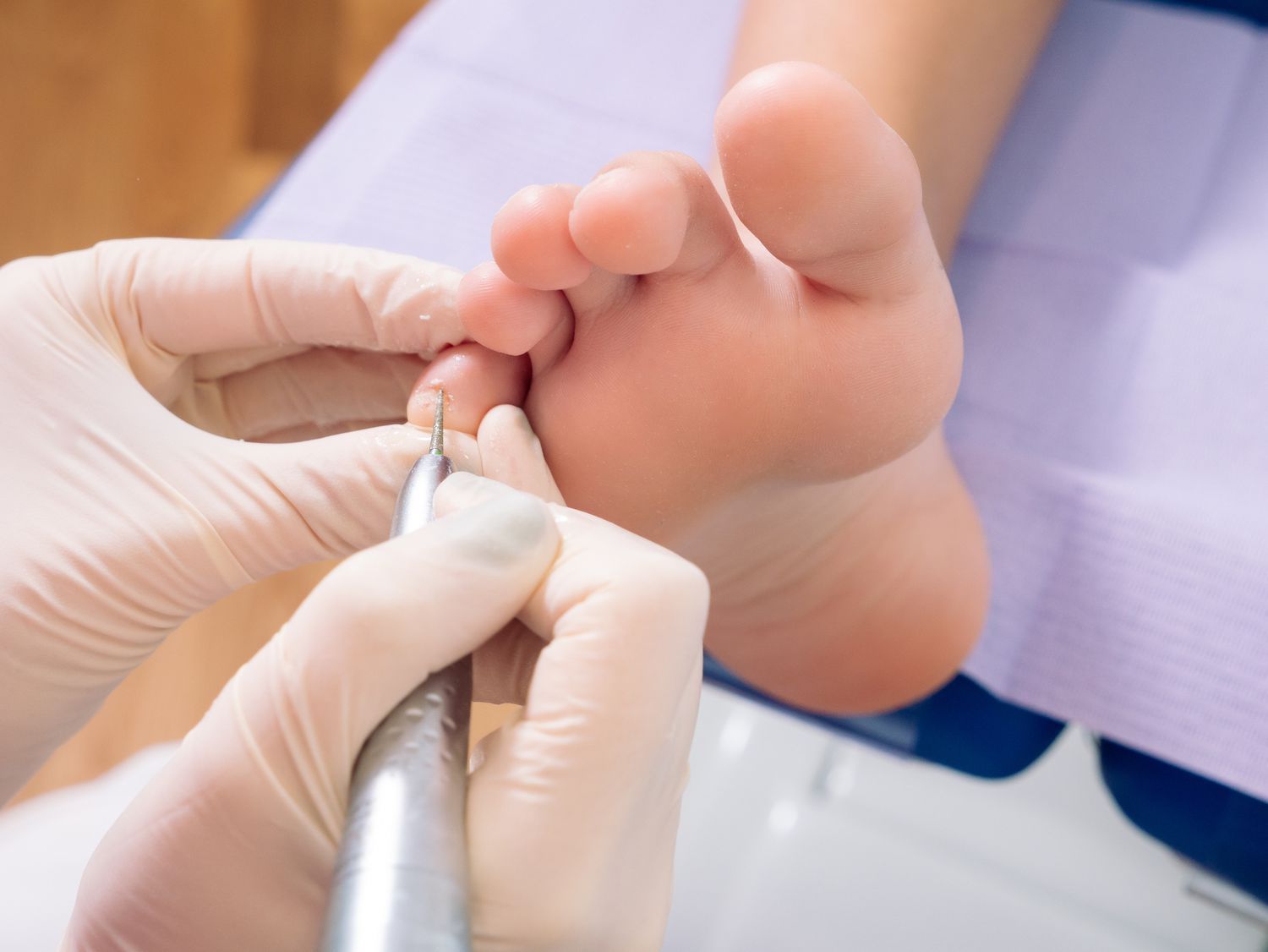 Podiatry compounding solutions at Rock Ridge Pharmacy