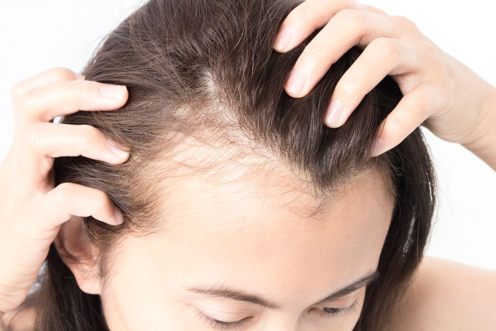 Alopecia Areata Treatment